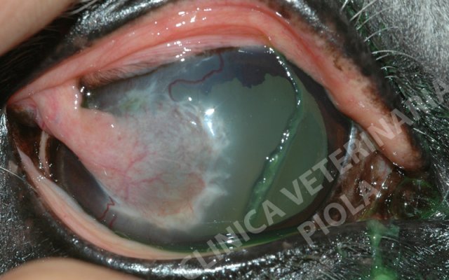 Esito lembo congiuntivale peduncolato